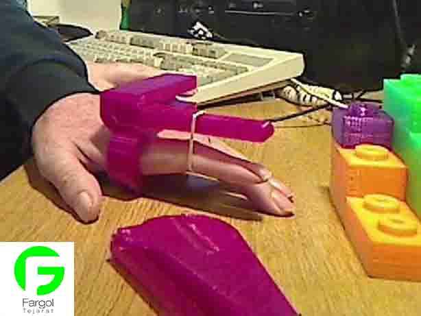 با پرینتر سه بعدی ابزار ورزشی مخصوص دست های آسیب دیده بسازید